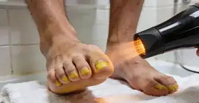 Foto: (Imagem sem texto alternativo disponivel ID [2735290])