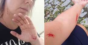 Após denunciar agressão, ex-paquita Pituxita é vista se mutilando