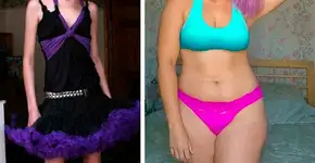 Blogueira que venceu a anorexia inspira o amor pelo nosso corpo