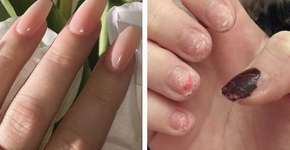 Foto: (Imagem sem texto alternativo disponivel ID [1183647])