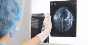 Foto: (Getty Images/iStockphoto)