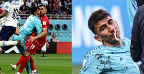 Vídeo: goleiro do Irã sofre lesão grave com possível dano ao cérebro