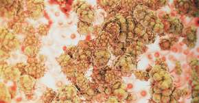 Foto: (IherPhoto/istock)