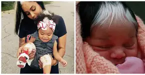 Conheça Milli, a bebê que nasceu com o cabelo branco