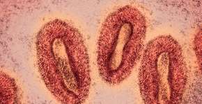 Foto: (narvikk/istock)