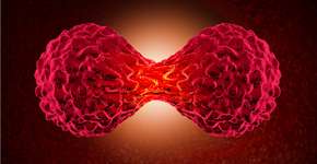 3 tipos de câncer que se desenvolvem silenciosamente para ficar atento