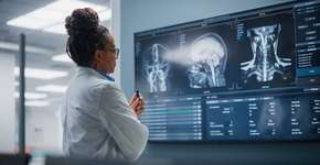 Esta dieta ajuda a preservar as funções cognitivas, afirma estudo