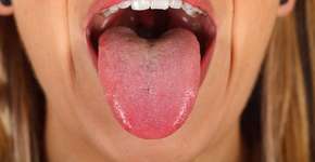 Foto: (Ocskaymark/istock)