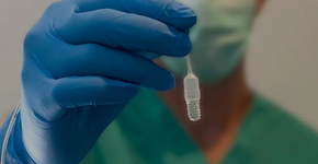 Foto: (reprodução/Lucid Diagnostics)