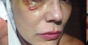 Foto: (Imagem sem texto alternativo disponivel ID [1103589])