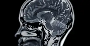 Foto: (mr.suphachai praserdumrongchai/istock)