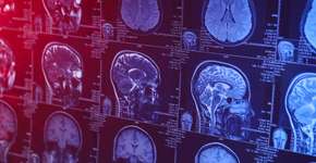 Alguns traços de personalidade podem ser mais propensos à demência, sugere estudo