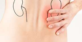 Foto: (marvinh/istock)