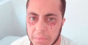 Thammy Miranda aposta em tatuagem para camuflar olheiras