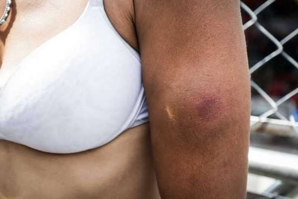 As agressões aos moradores da cracolândia são frequentes