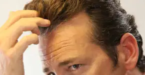 Bebida que causa a queda de cabelo