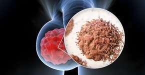 Foto: (Depositphotos/katerynakon)