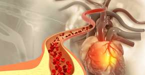 Foto: (iSTock/Mohammed Haneefa Nizamudeen)