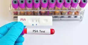 Foto: (jarun011/istock)