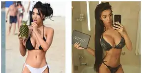 Modelo britânica choca ao compartilhar fotos na mesa de cirurgia