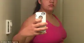 Jovem perde 52 kg sem recorrer à cirurgia após o término de um namoro