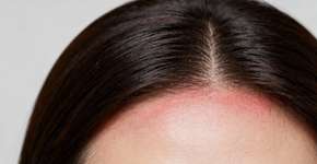 Foto: (Imagem sem texto alternativo disponivel ID [2670397])