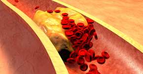 Foto: (Ralwel/istock)