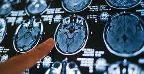 Esta mania anti-higiênica aumenta risco de ter Alzheimer, diz estudo