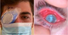 Foto: (reprodução/tiktok/Mike Krumholz,)