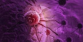 Foto: (vitanovski/istock)