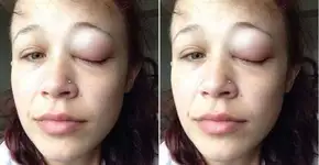 Foto: (Imagem sem texto alternativo disponivel ID [1499012])