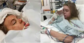 Mãe publica alerta após filha entrar em coma por causa de ecstasy