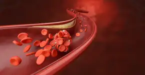 Como controlar o colesterol alto levando em conta a genética e a prevenção