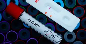 Foto: (HIV/iStock)