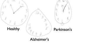 MIT cria caneta que detecta sinais precoces de Alzheimer e Parkinson