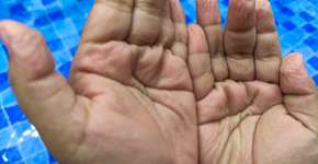 Foto: (iStock/Andik Tri Witanto)