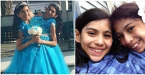 Apesar de risco para saúde, gêmeas siamesas não querem se separar