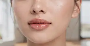 Foto: (Imagem sem texto alternativo disponivel ID [2731443])