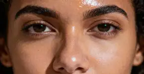 Você está lavando o rosto demais? O efeito rebote da pele oleosa que ninguém te conta