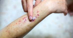 Foto: (Getty Images)