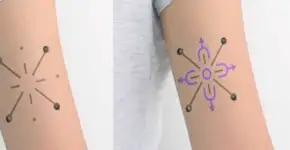 Tatuagem que muda de cor é esperança para controle de diebetes
