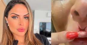 Irmão publica vídeo de apresentadora da Record machucada após agressão de ex