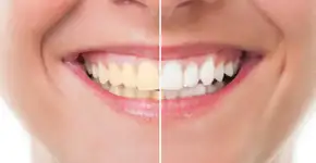 Foto: (Getty Images/iStockphoto)