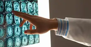 Semente atua contra o câncer e reduz risco de AVC; saiba qual e como