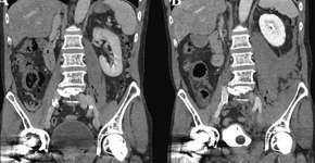Foto: (reprodução/Journal of Surgery Case Reports)