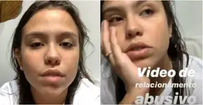 Ex-Chiquitita Bruna Carvalho revela relacionamento abusivo