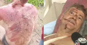 Homofobia na Paraíba: professor é espancado com madeira e chicote