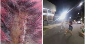 Mulher é vítima de agressão após bloco de Carnaval no AM