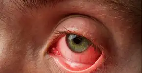 Foto: (Imagem sem texto alternativo disponivel ID [2462151])