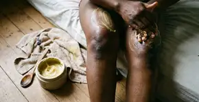 Como suavizar as manchas escuras nos cotovelos e joelhos e restaurar a uniformidade do tom naturalmente em casa